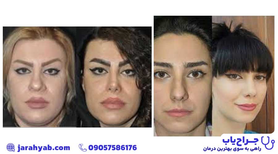 نمونه کار مهدی راستی اردکانی
