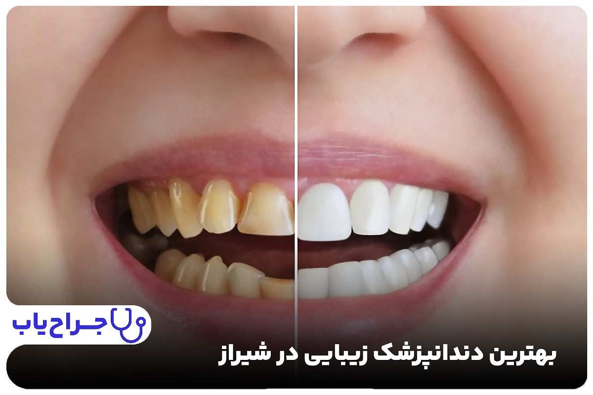 Dr. Younes qoreyshi