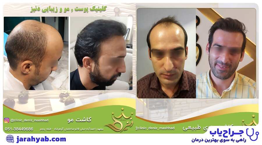 نمونه کار کلینیک تخصصی پوست و مو دنیز (Deniz Clinic)