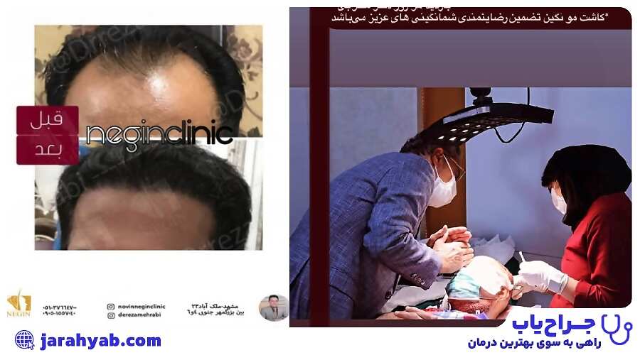 نمونه کار کلینیک زیبایی دکتر رضا محرابی (Dr. Reza Mehrabi Clinic)