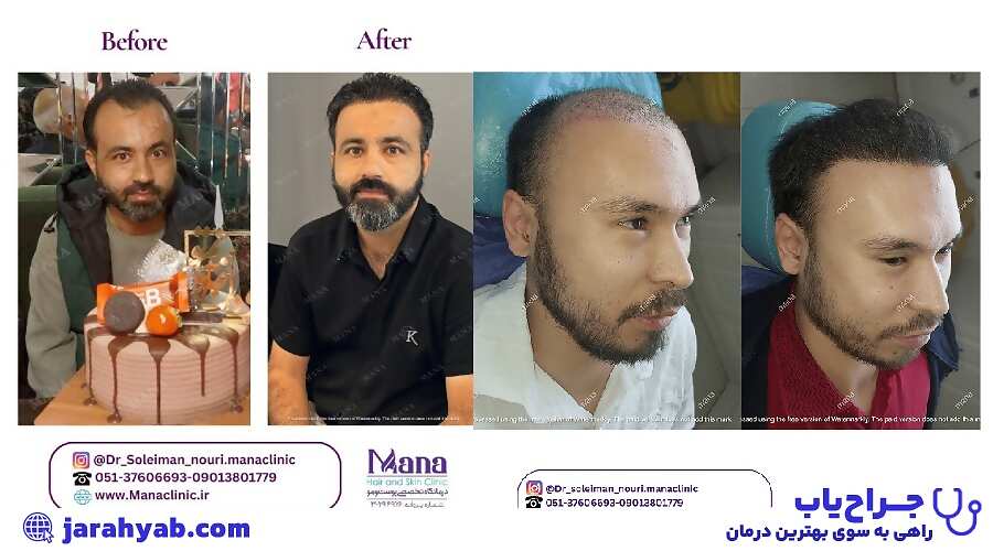 نمونه کار کلینیک تخصصی پوست و مو مانا