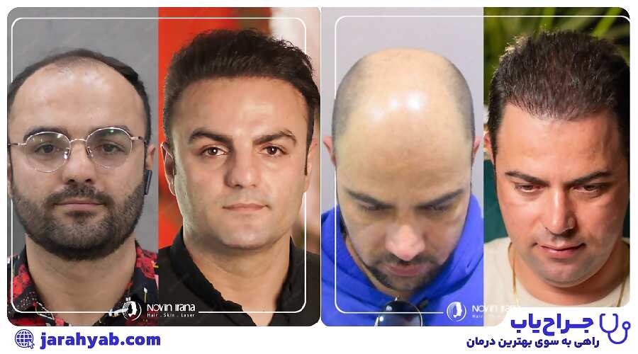 نمونه کار کلینیک تخصصی پوست و مو نوین ایرانا (Novin Irana Clinic)