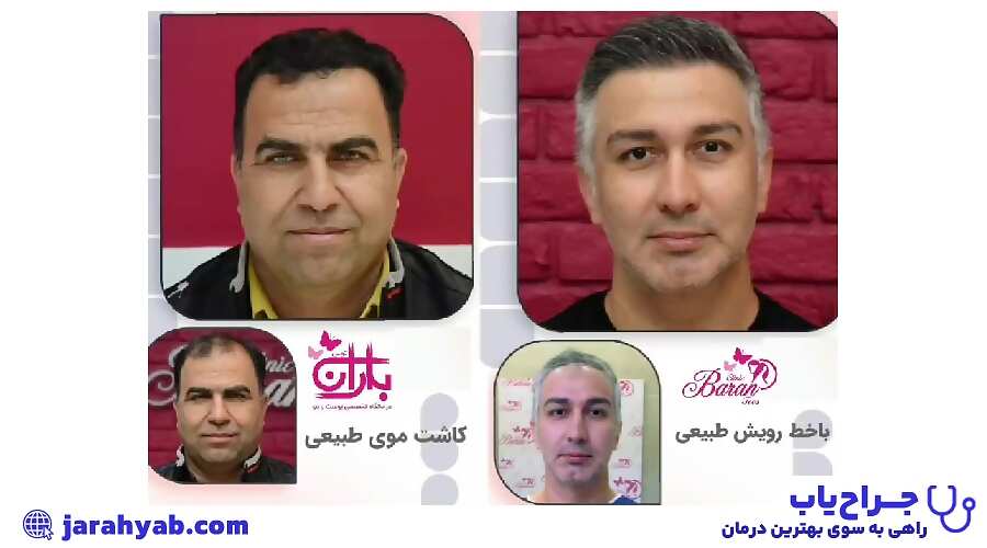 نمونه کار درمانگاه تخصصی پوست و مو باران توس (Baran Toos Clinic)