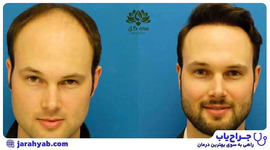 نمونه کار کلینیک تخصصی پوست و مو سی گل (Seagull Clinic)