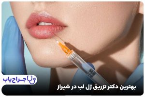 بهترین دکتر تزریق ژل لب در شیراز