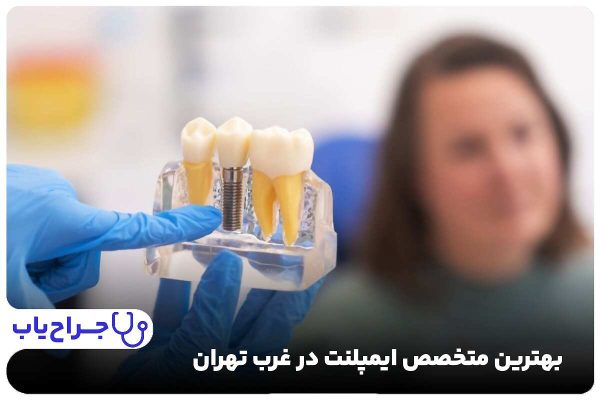 بهترین متخصص ایمپلنت در غرب تهران